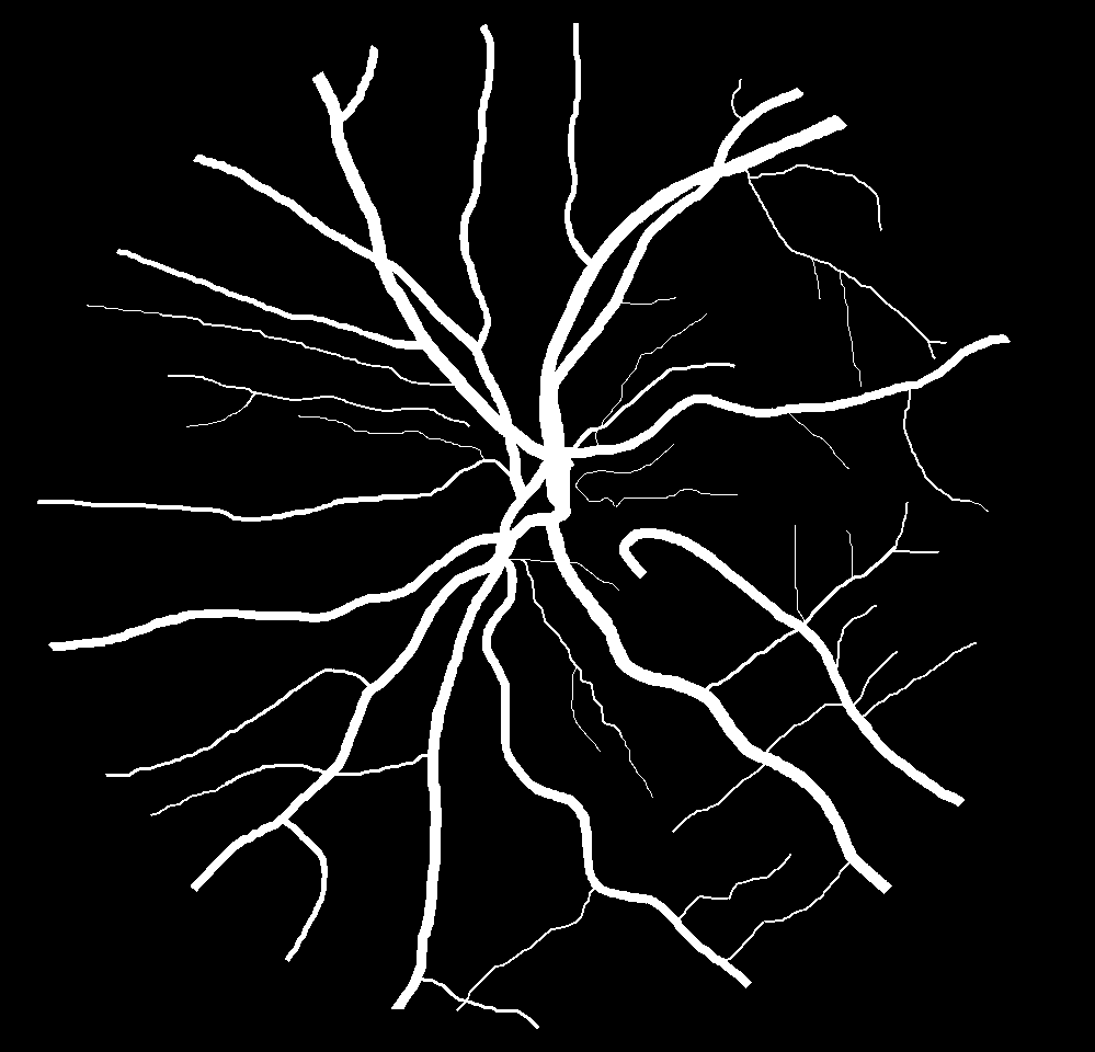 Retinal Damarlar